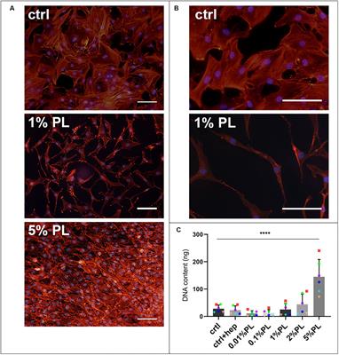 Importance of Timing of Platelet Lysate-Supplementation in Expanding or Redifferentiating Human Chondrocytes for Chondrogenesis